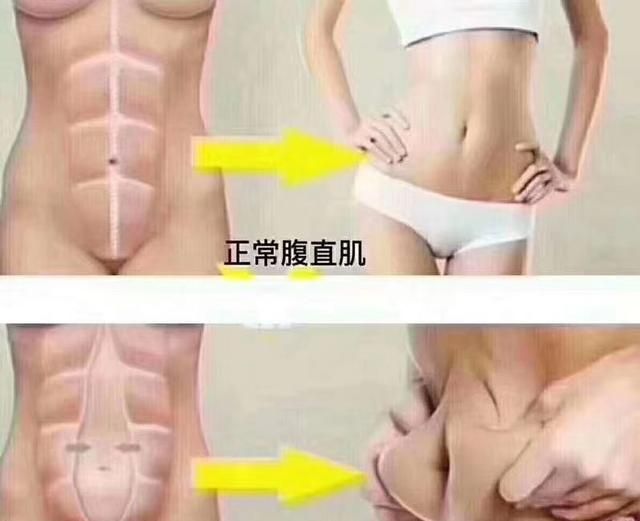 产后四个月母乳喂养能跑步减肥吗图7